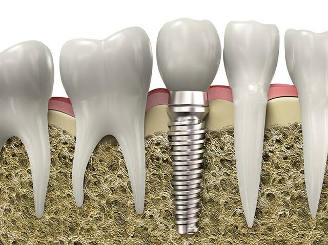 impaltation